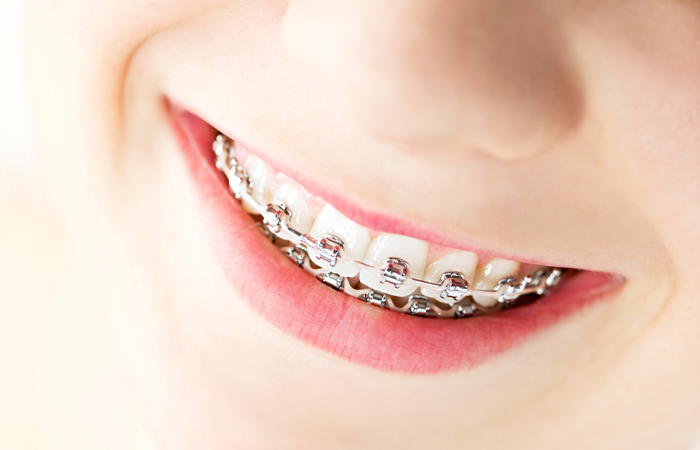 Orthodontisc