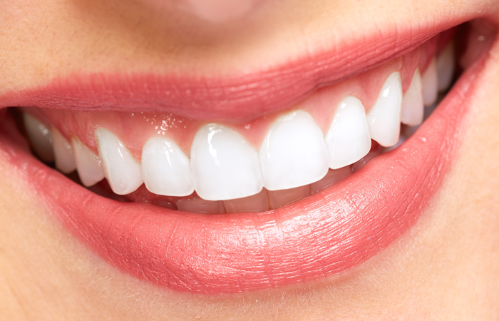 Veneers and crowns of zirconium